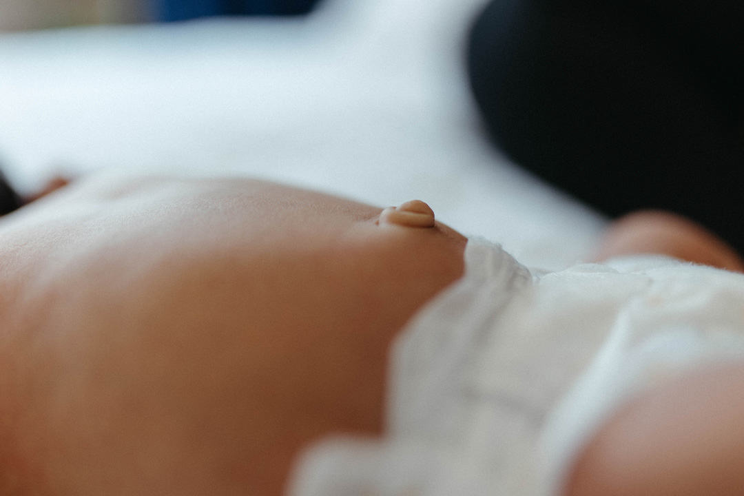 baby belly button